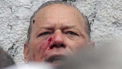 Sergio Berni se toma licencia médica hasta el 25 de mayo