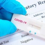 La ANMAT autorizó la venta de cuatro autotest de Covid en las farmacias