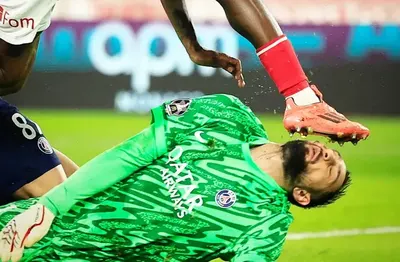 Así le quedó la cara a Gianluigi Donnarumma, al recibir un tremendo planchazo