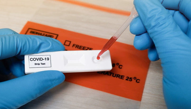 Sigue la disputa por los test rápidos: “No se puede prohibir el acceso democrático”