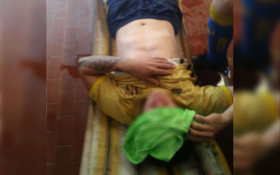 Un futbolista denunció que le arrojaron agua hirviendo en un partido de la Liga Platense